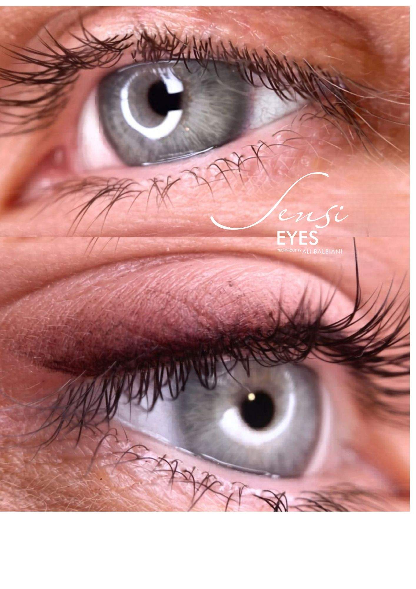 Resultado Sensi Eyes®