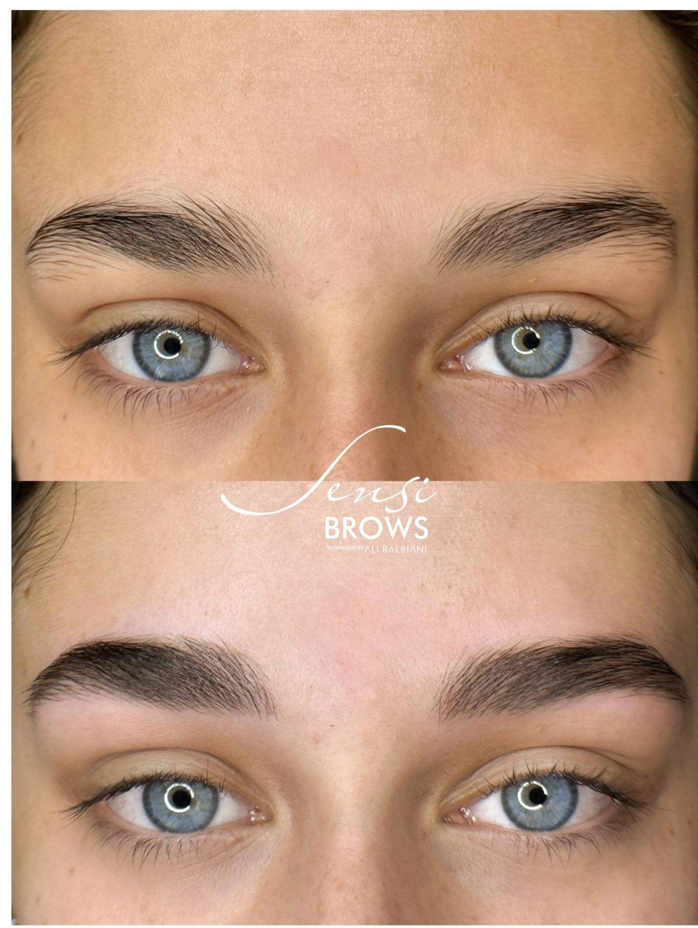 Resultado Sensi Brows®